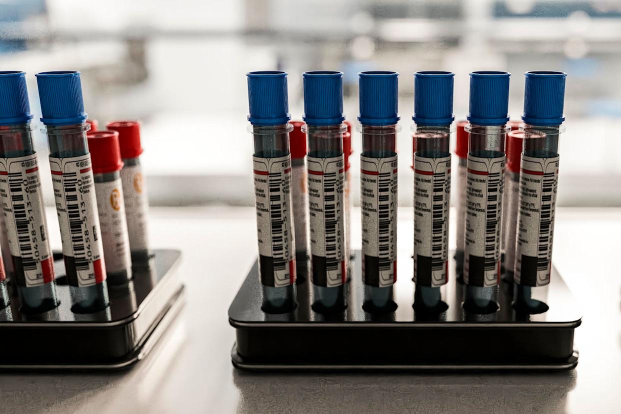 Blood samples in test tubes for medical diagnostics (Getty Images)