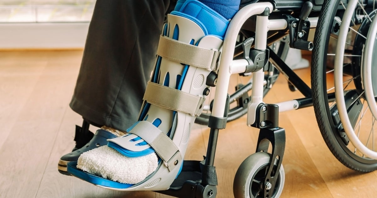 Florida nursing assistant sentenced to 9 years for $11 million scheme that sent unnecessary braces to seniors