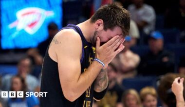 LA Lakers star Luka Doncic covers his face with his hands as he walks off the court after suffering an injury