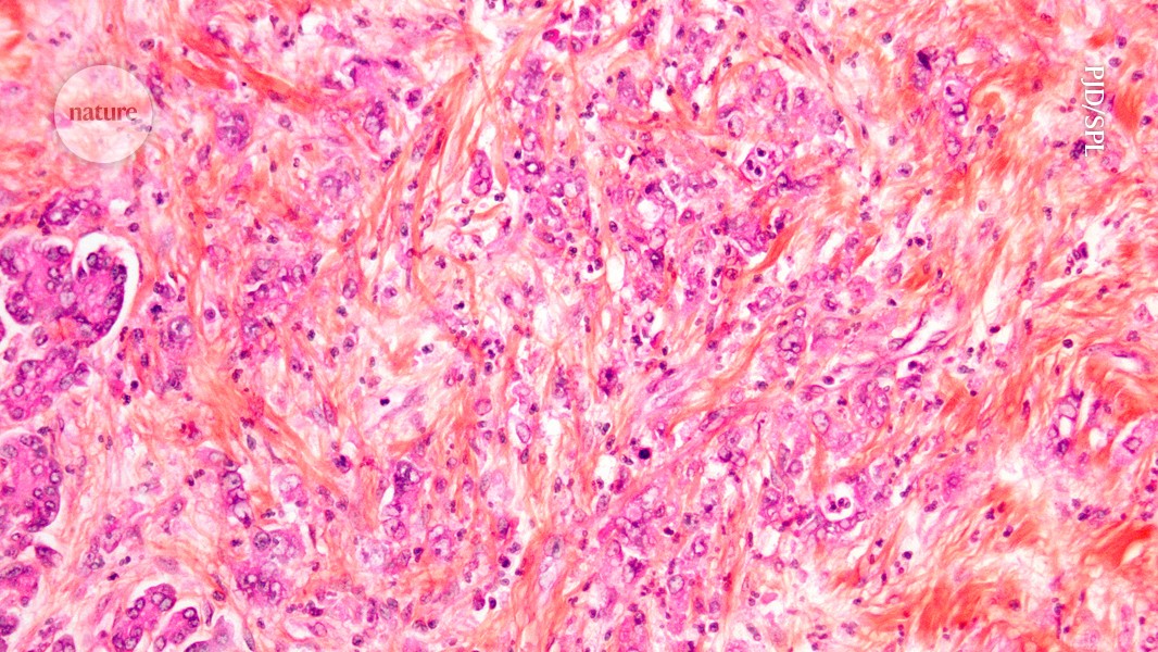 New drugs take aim at one of cancer’s deadliest mutations