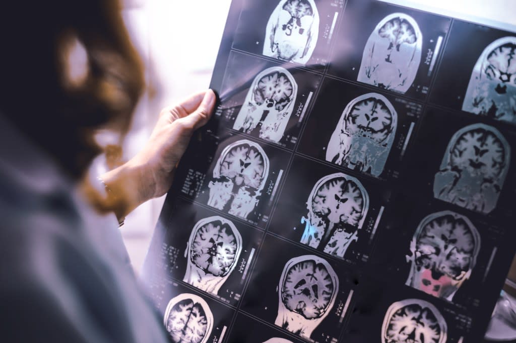 A first-time seizure in adulthood was linked to a higher risk of developing neurological cancer within a year of the incident. Atthapon – stock.adobe.com