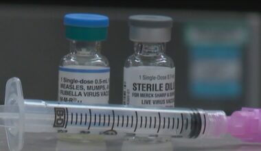 Measles case confirmed in Lake County resident