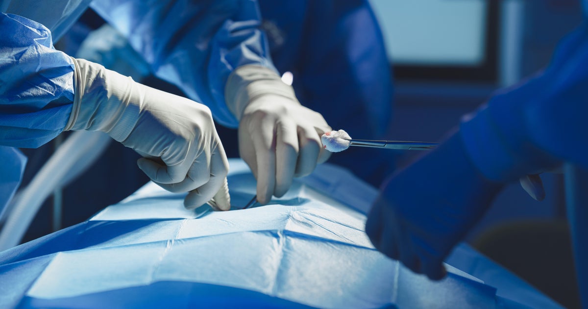 Florida doctor indicted after allegedly removing patient's liver instead of spleen in fatal surgery