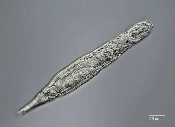 A rotifer seen under a microscope. Michael Plewka