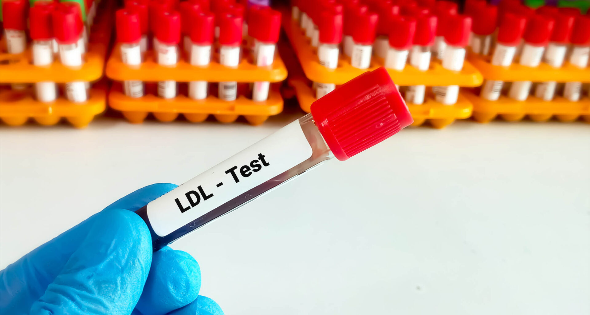 Doctors updated the LDL cholesterol target for optimal heart health