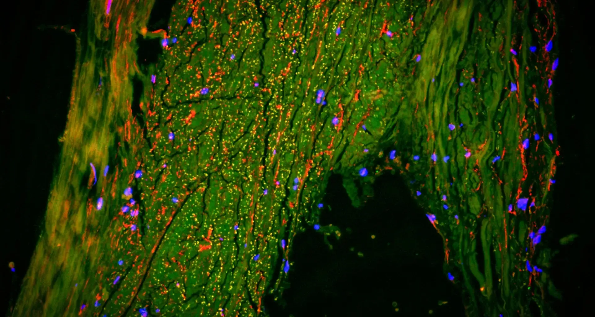 Scientists just found a hidden “drain” inside the human brain