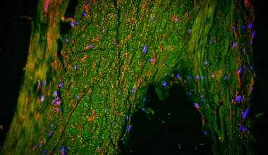 Scientists just found a hidden “drain” inside the human brain