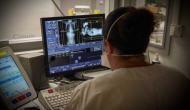 Doctor observing the images of a scanner in the emergency room of a university hospital.