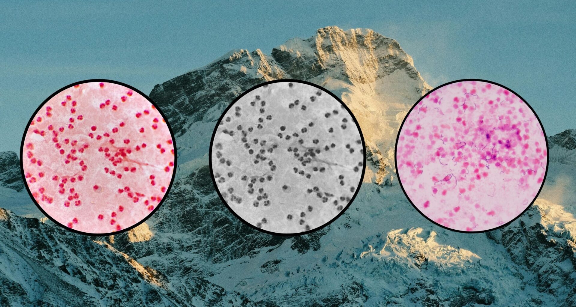 a picture of bacteria petri dishes on a mountain background to depict gut health at altitude