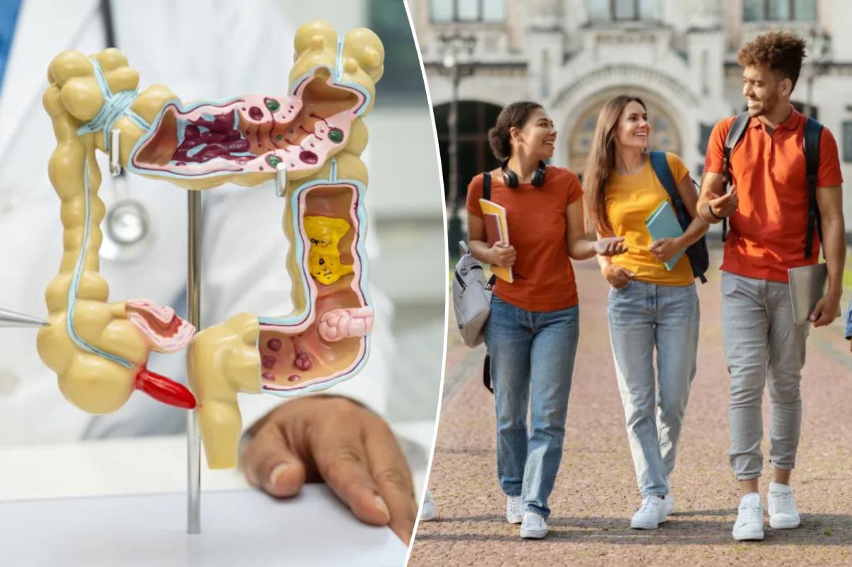 Concerning rise in colon cancer deaths concentrated in one group