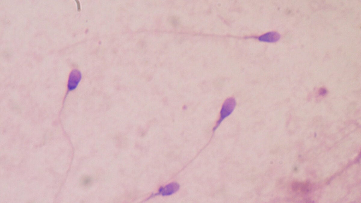 Utah Startup Claims Its Lab-Grown Sperm Can Produce Embryos, in Potential Fertility Breakthrough