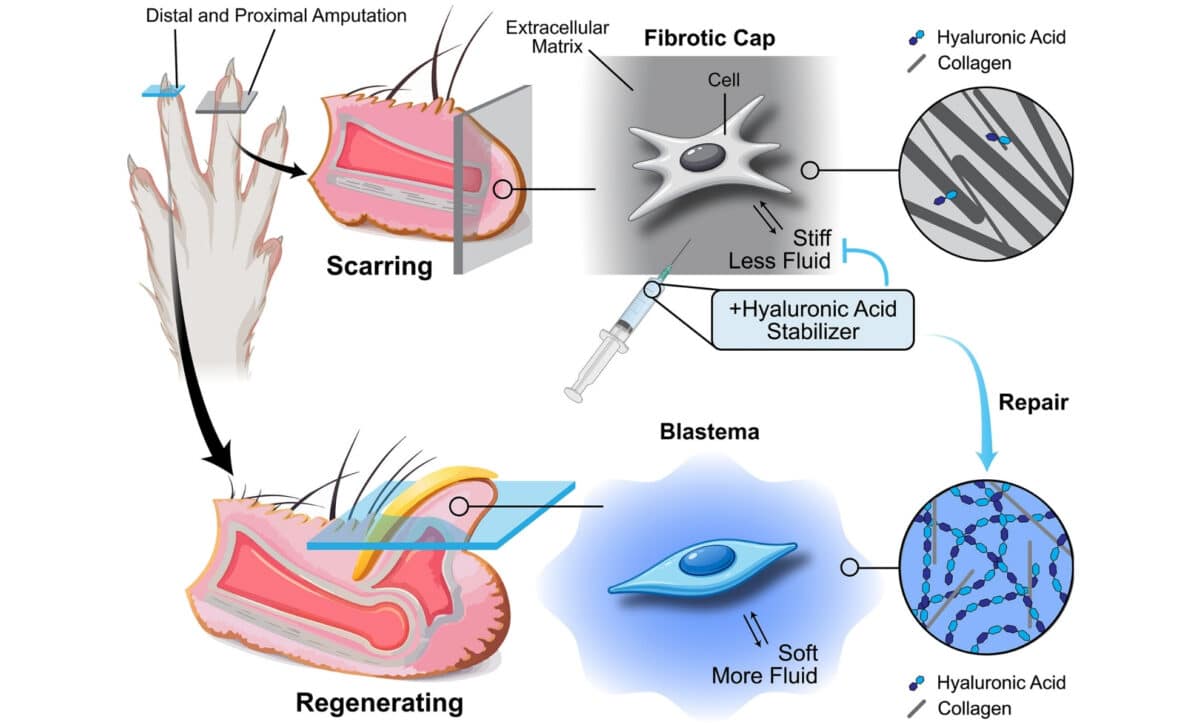 The Ecm And Tissue Mechanics Direct Wound Healing Outcomes After Digit Amputations