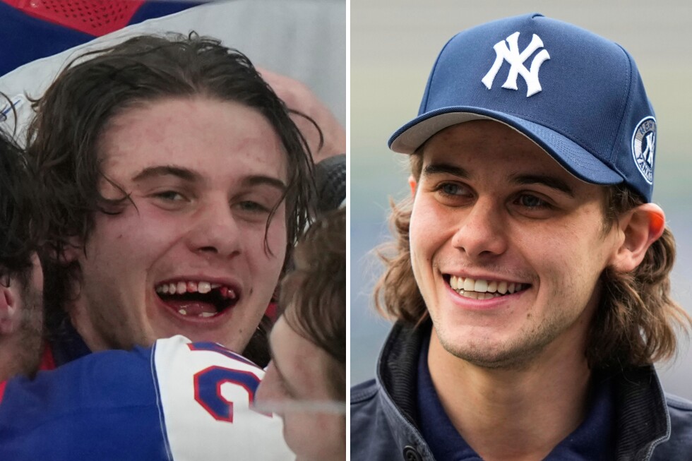 Jack Hughes' golden goal is a reminder of how important hockey dentists are