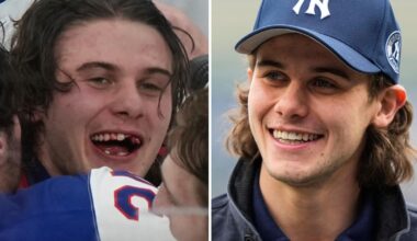 Olympic hero Jack Hughes has new chiclets as NHL dentists get moment in the spotlight