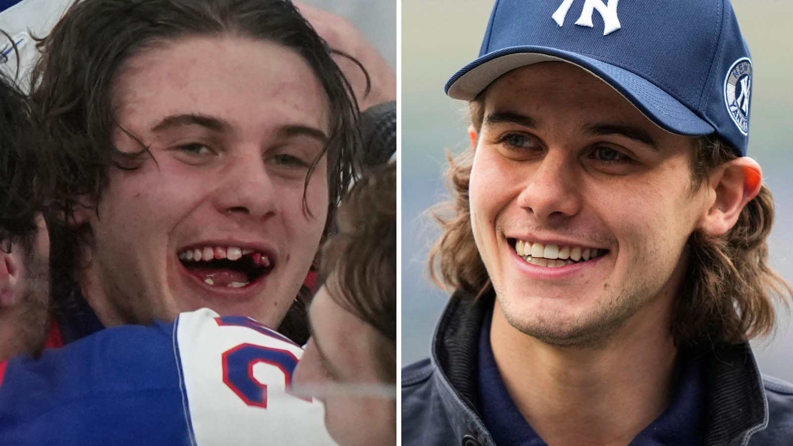 Olympic hero Jack Hughes has new chiclets as NHL dentists get moment in the spotlight