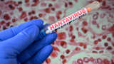 ILLUSTRATION of hantavirus testing concept with laboratory tubes containing cotton swabs and HANTAVIRUS labels photographed in front of a public domain hantavirus related microscopic image released by the U.S. Centers for Disease Control and Prevention in Paris, France, May 8, 2026.