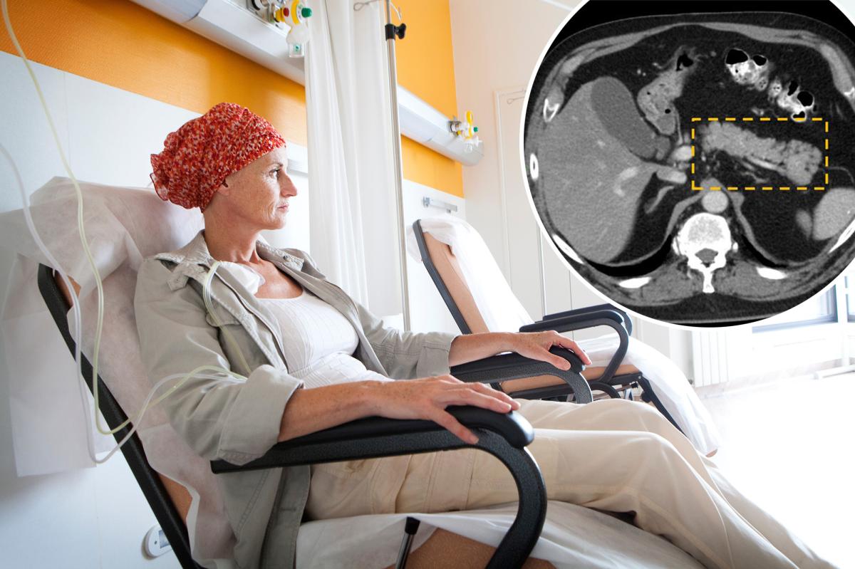 New tool finds deadliest cancer years before tumors seen on scan