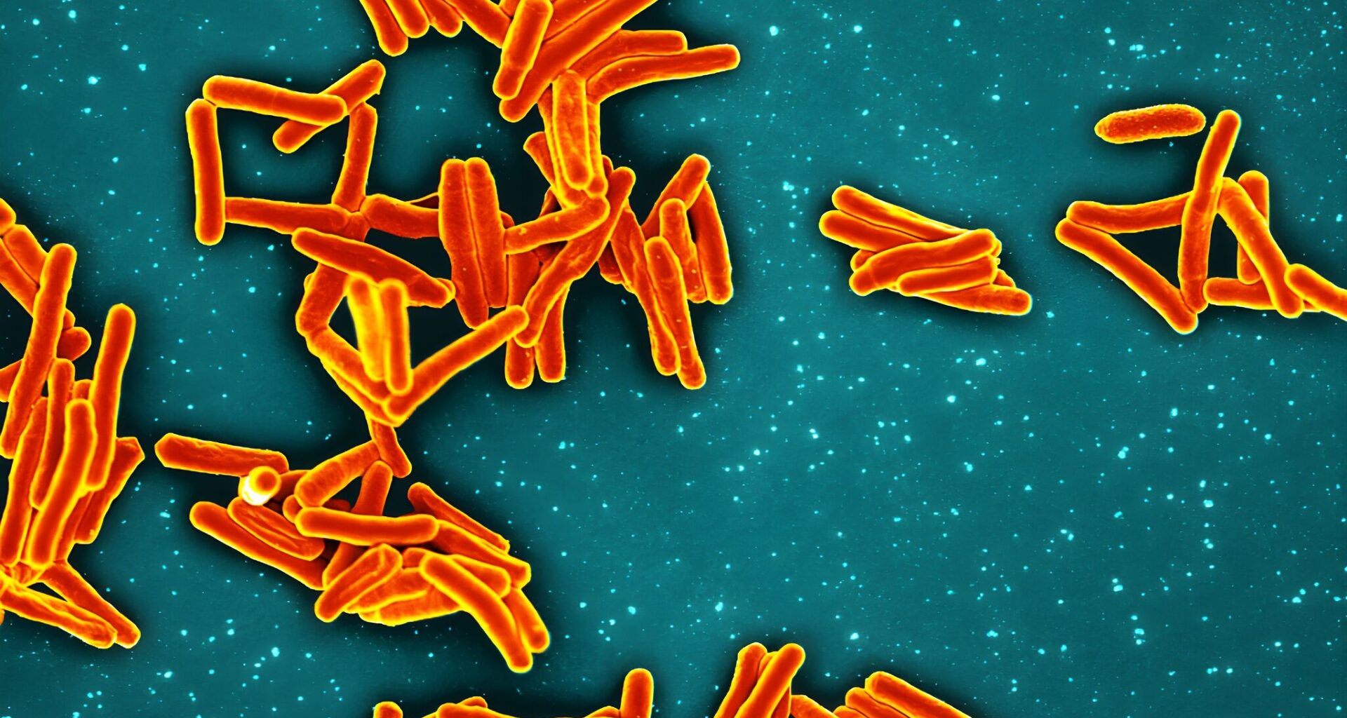 Nearly 1 in 5 affected by TB at SF school