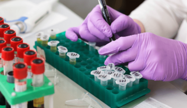 FDA Resubmission Path for Tab-cel Keeps Atara’s (ATRA) Regulatory Timeline Alive