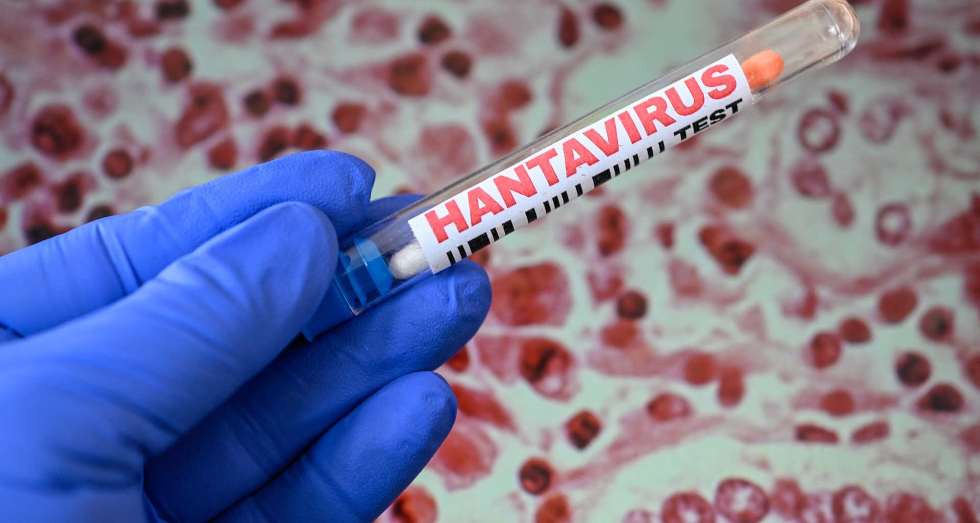 Hantavirus cases spark surge in pharma, biotech stocks — here’s why