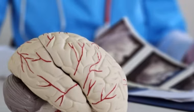 doctor looks at brain scans and a model of the brain