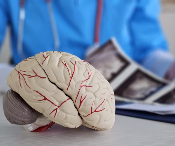 doctor looks at brain scans and a model of the brain