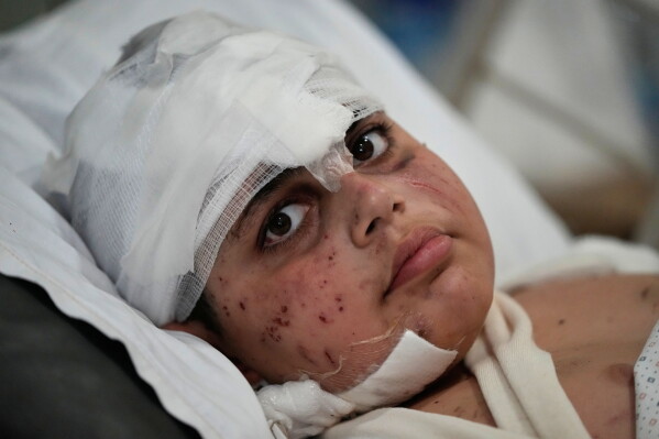Ali Salman, 12, who was injured in an Israeli airstrike, lies on a bed at Jabal Amel hospital in the southern port city of Tyre, Lebanon, Tuesday, May 26, 2026. (AP Photo/Mohammed Zaatari)