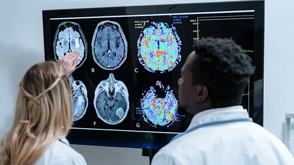Female and male doctors examining a brain scan on a large screen