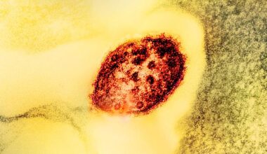 Image of a colorized transmission electron micrograph of a measles virus particle (red).