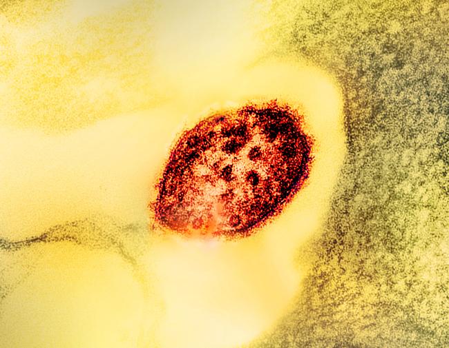 Image of a colorized transmission electron micrograph of a measles virus particle (red).