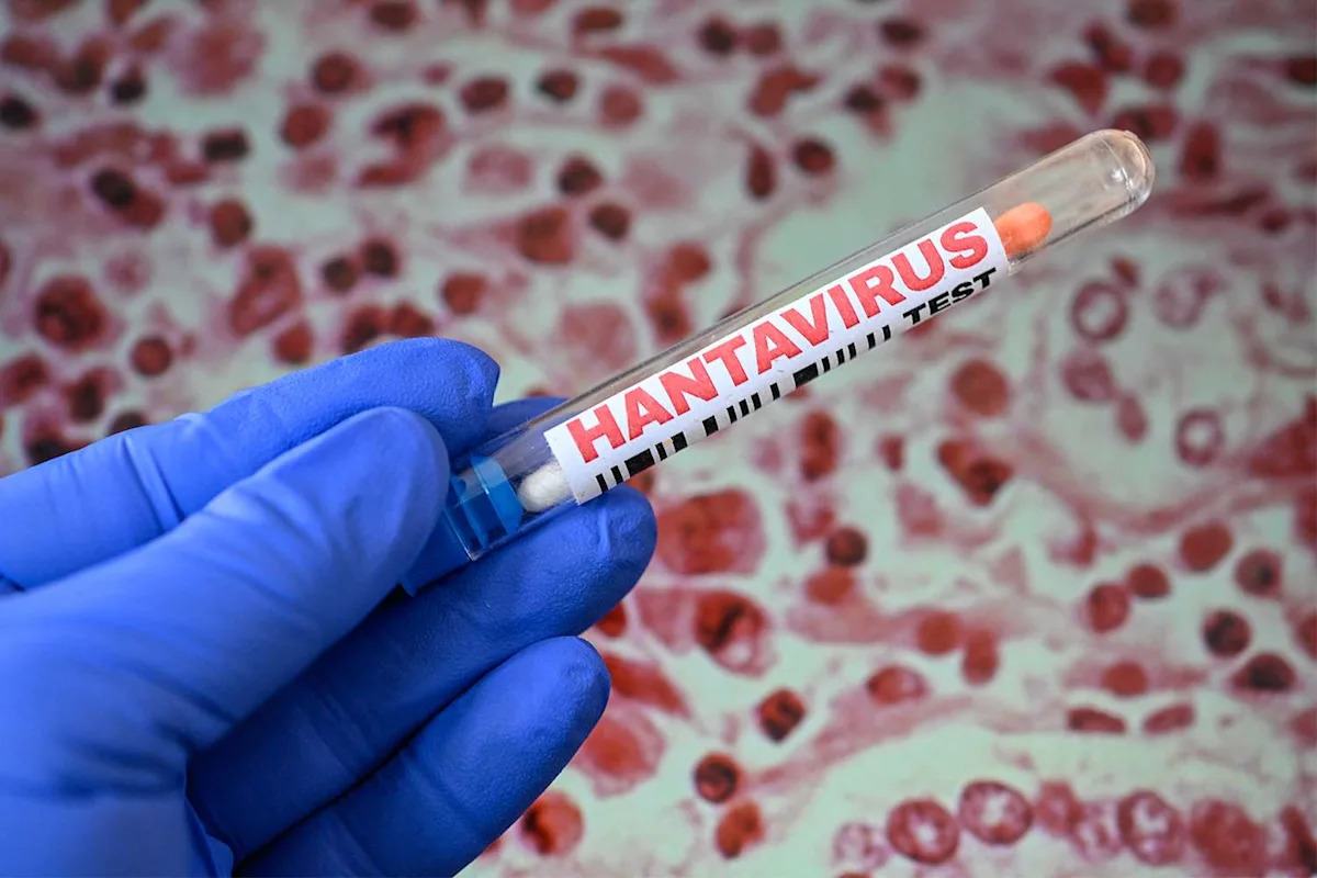 Hantavirus Death Confirmed in Colorado as Health Officials Launch Investigation