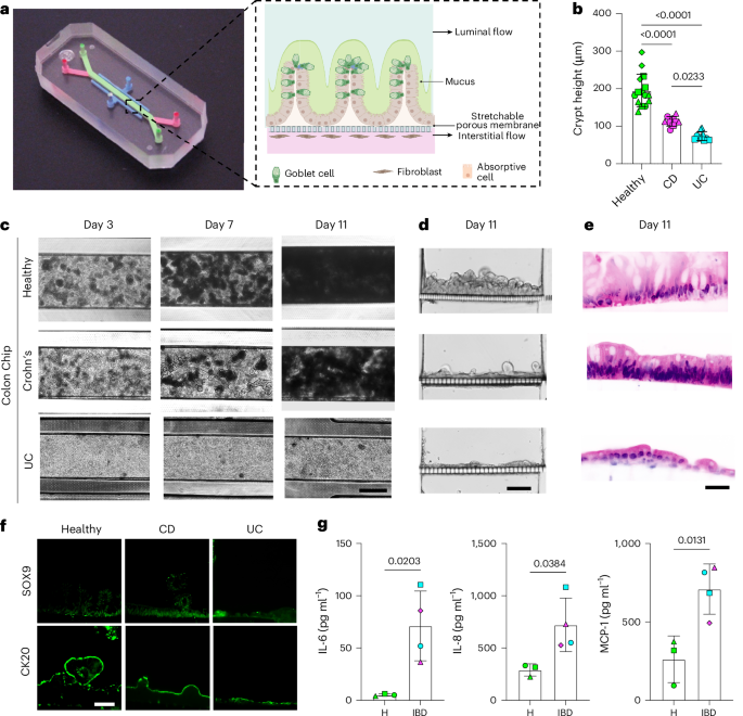 Human inflammatory bowel disease-on-a-chip for modelling disease progression, cancer initiation and sex-specific effects