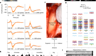 Plasticity and language in the anaesthetized human hippocampus
