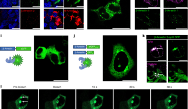 β-Arrestin condensates regulate G-protein-coupled receptor function