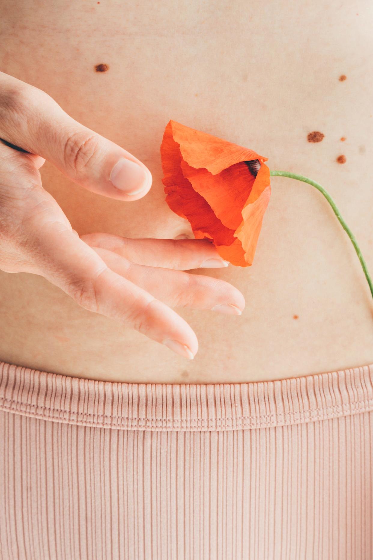 Young woman belly with red flower. Naked abdomen with many birthmarks.