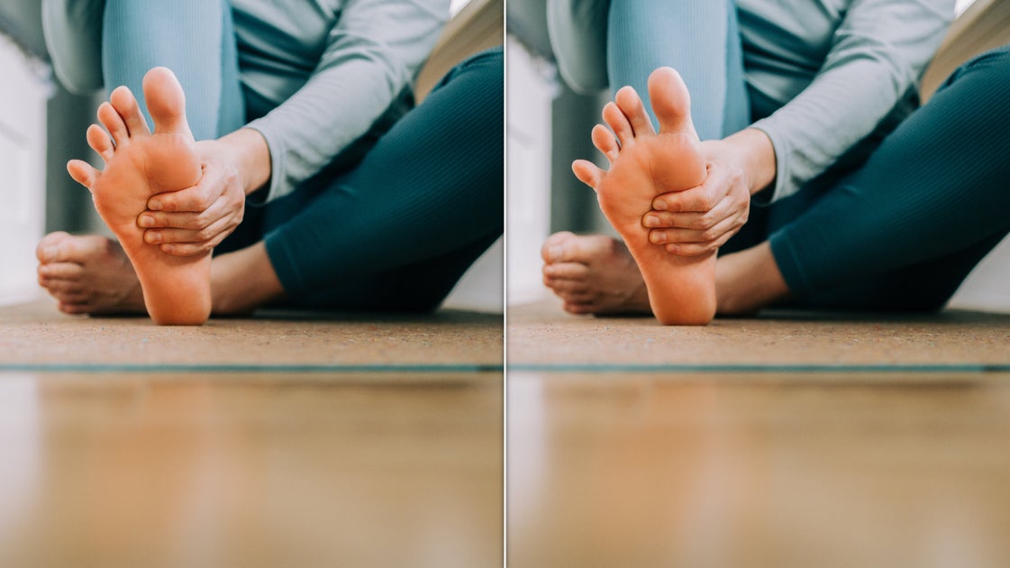 Here’s How To Tell If Your Flat Feet Are Actually Causing Health Problems