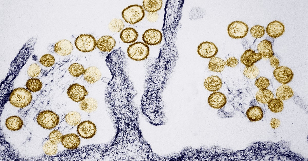 Adult Dies Of Hantavirus In Colorado, State Health Officials Say