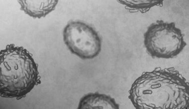 Wisconsin DHS confirms 5 mpox cases | Health Watch