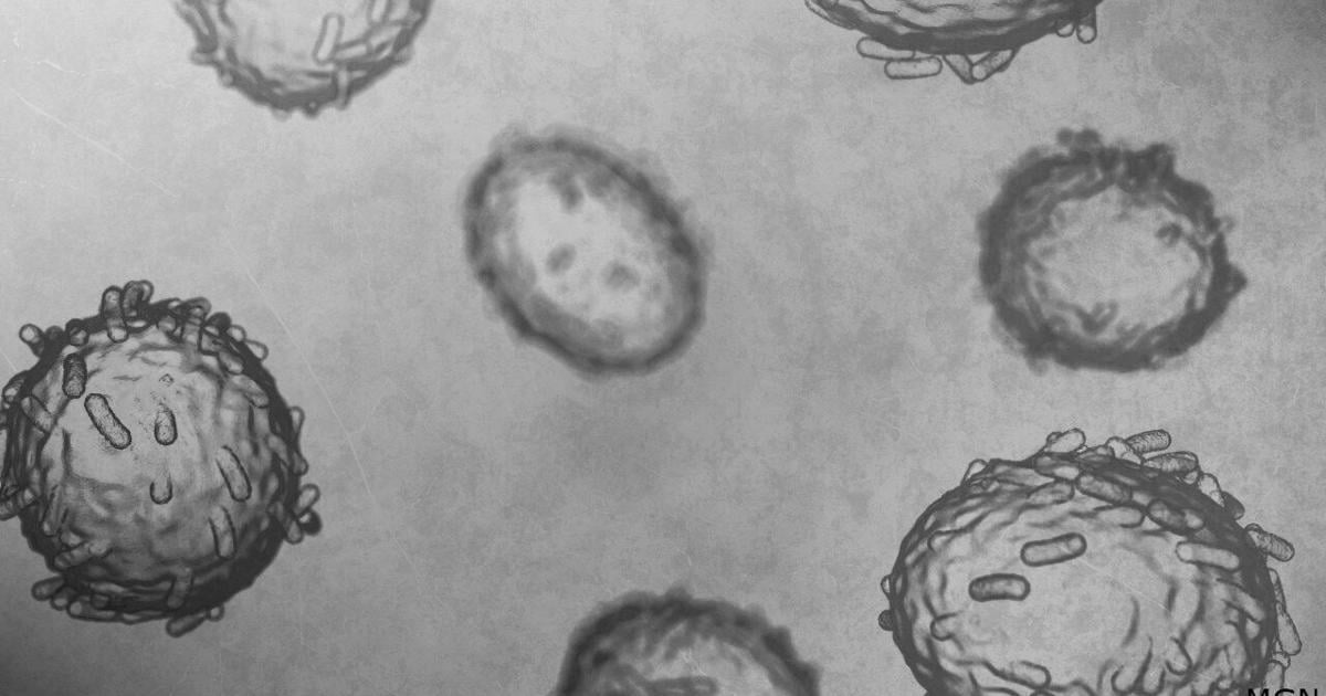 Wisconsin DHS confirms 5 mpox cases | Health Watch