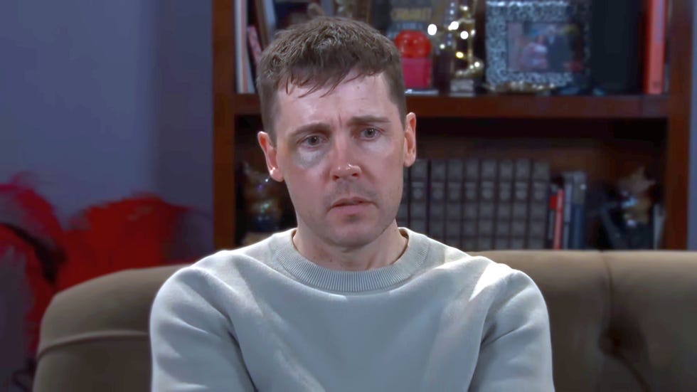 Coronation Street Todd Grimshaw coronation street todd grimshaw with a black eye looking spaced out on the sofa