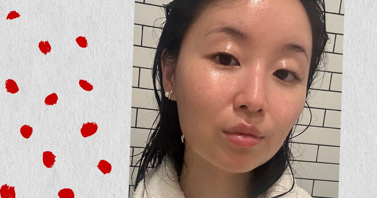 What Is an Accutane Nose Job?