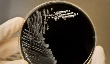 18 cases of legionella, waterborne bacteria, found at Kaiser Santa Clara hospital – The Mercury News