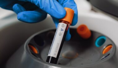 'Forever Chemicals' Found in 98.8% of Human Blood Samples Tested : ScienceAlert