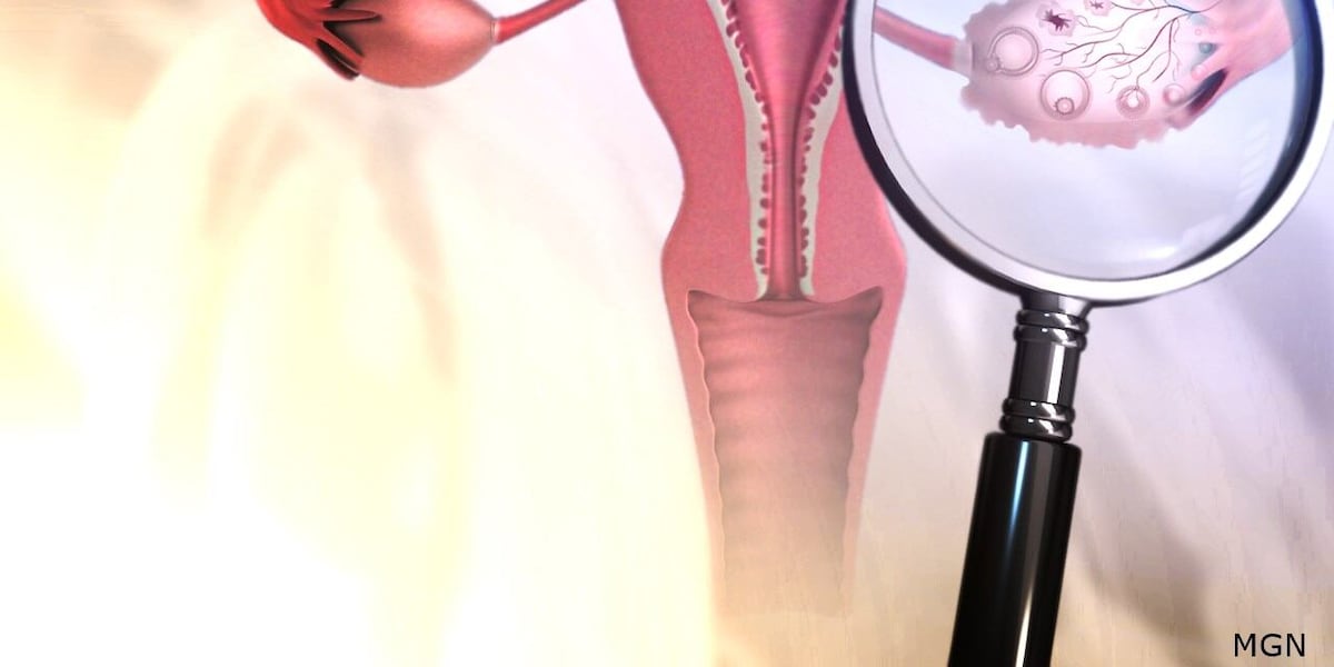 PCOS gets a new name to better reflect the condition