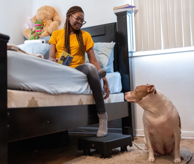 Jasmine Jones, 28, stops to look at her dog Dutches as she reads on her bed at home in Chicago's Calumet Heights neighborhood on May 17, 2026. Jones had a quadruple transplant in January due to Cystic Fibrosis. "I love my family, they mean everything to me," Jones said. "I'm happy that I was allowed more time to spend with them." (Josh Boland/Chicago Tribune)