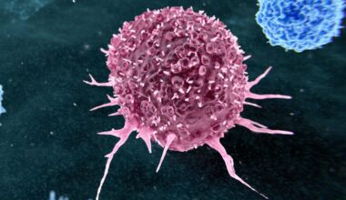 Almost 50% of Preventable Cancers Linked to Just Two Lifestyle Habits : ScienceAlert