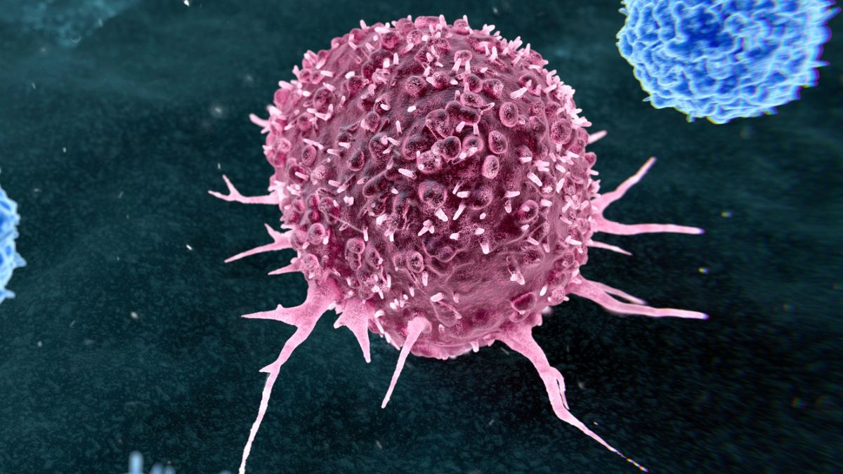 Almost 50% of Preventable Cancers Linked to Just Two Lifestyle Habits : ScienceAlert