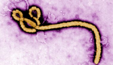 Ebola, hepatitis B, long Covid, Christianity: Morning Rounds