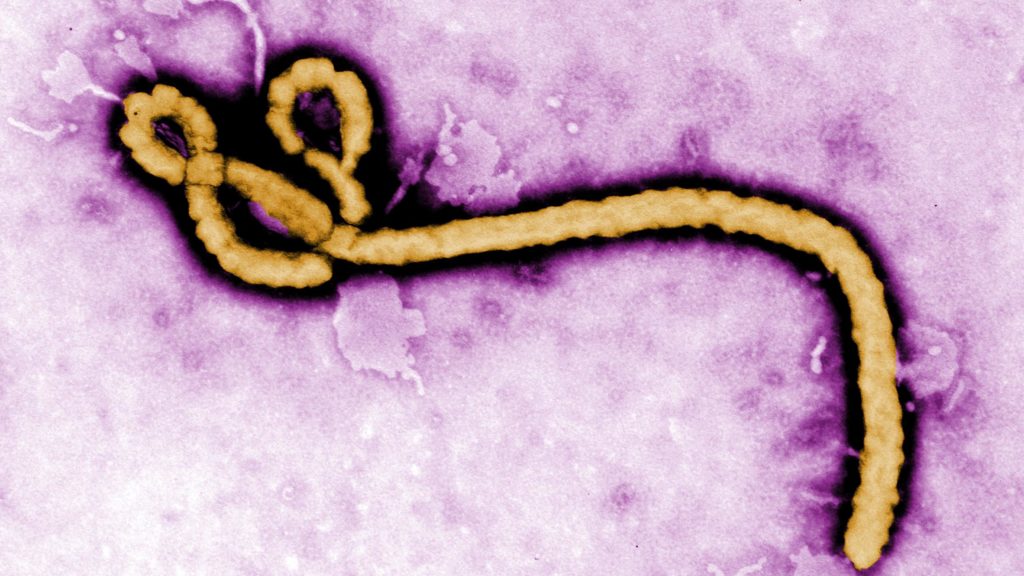 Ebola, hepatitis B, long Covid, Christianity: Morning Rounds