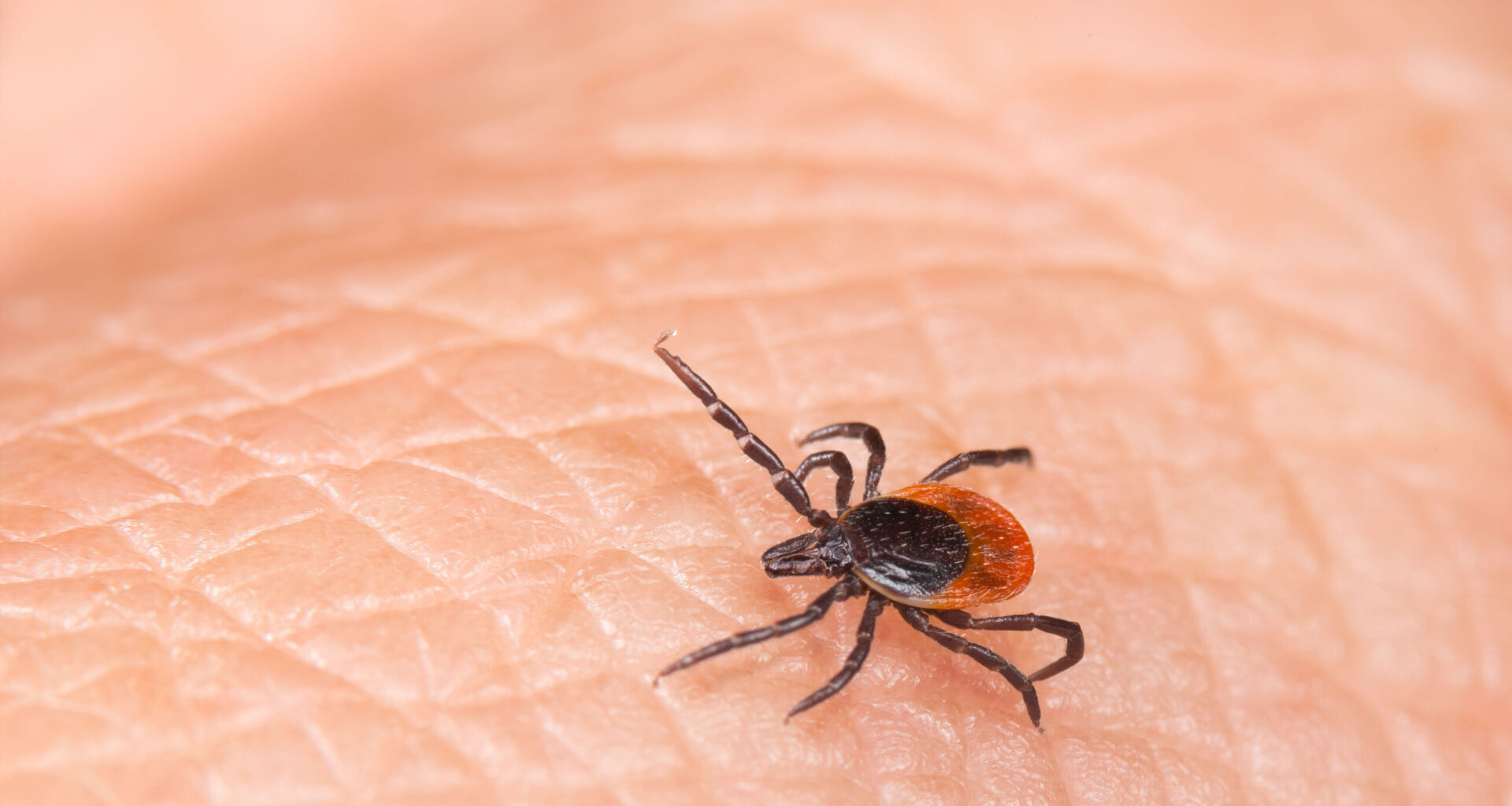 DC-area emergency rooms are seeing more patients with tick bites
